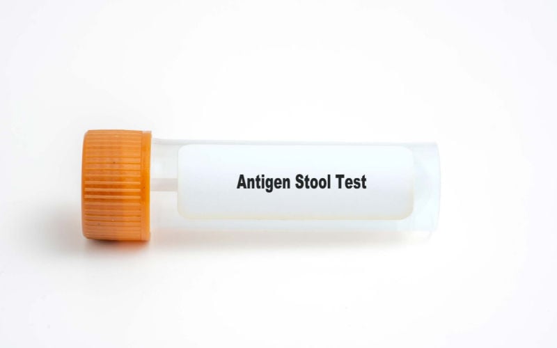 antigen stool test