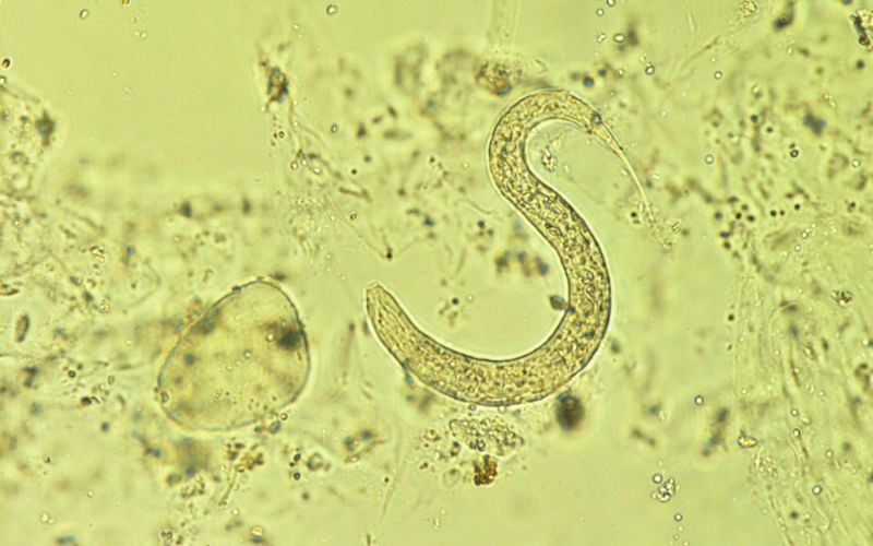 hookworm in fecal smear test